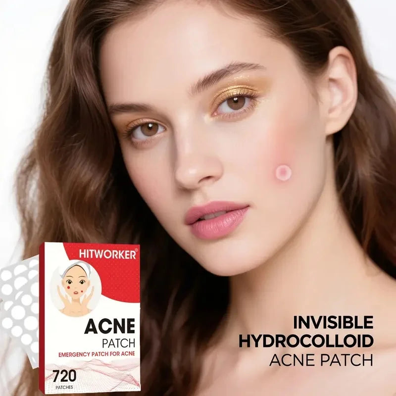 720 Pcs Acne Patches | Alcohol-Free, Gentle & Non-Irritating - Waterproof & Breathable, Essential for Facial Care
