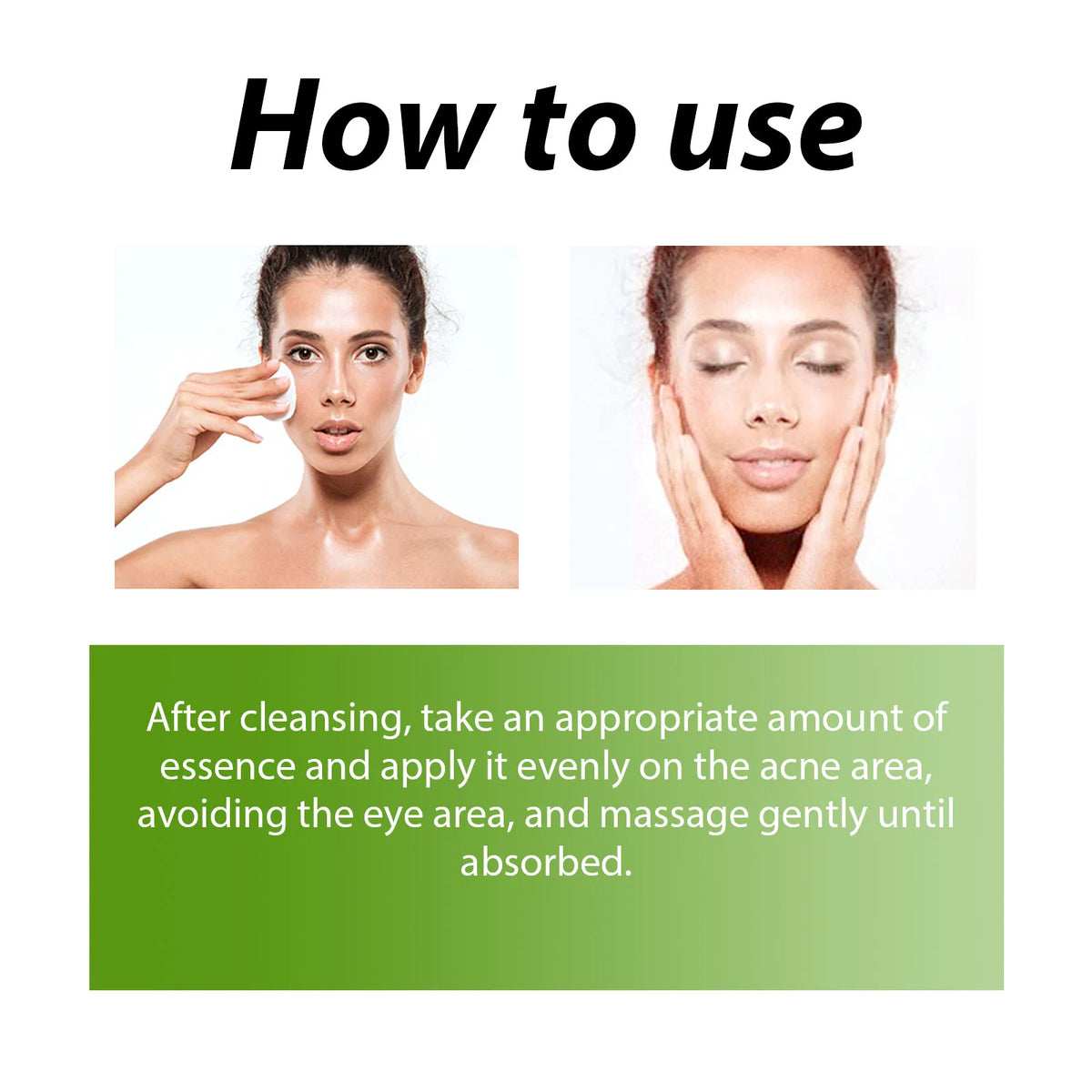 Acne Face Cream Pimple Treatment Oil Control Repair Redness Remove Blackhead Smooth Hydrating Moisturizing Pore Shrinking Serum