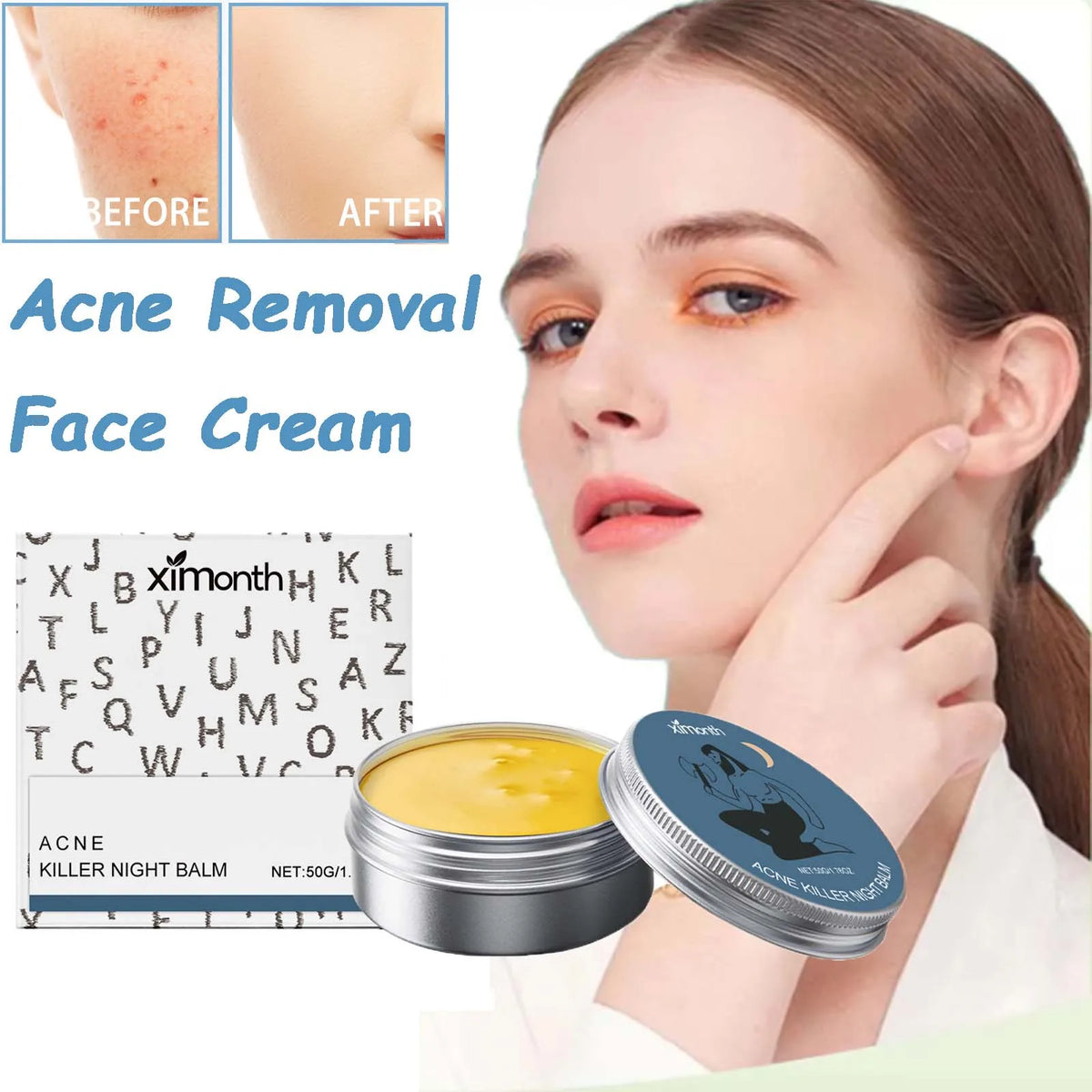 Acne Removal Face Cream Gently Balances Skin Oil Refreshing Skin Care Shrink Pores Oil Control Hydrating Anti Acne Cream