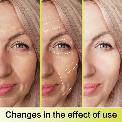 Anti-Aging Retinal Serum 15ml - 0.1% Nano Retinal + MATRIXYL® 3000 3% tightens skin, fights wrinkles &amp; shrinks pores.