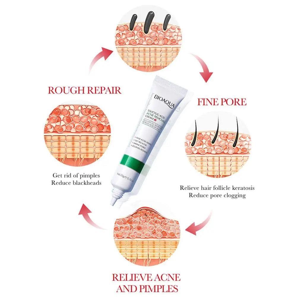 BIOAQUA Salicylic Acid Face Cream Acne Treatment Scar Mark Repair Moisturizing Blackhead Remover Facial Cleanser Skin Care
