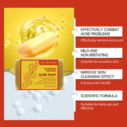 Acne Treatment Soap Pimple Remove Pigment Deep Cleansing Pores Shrink Oil Control Moisturize Body Face Lightening Skin Care Soap